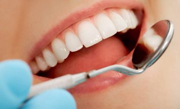Самый простой способ поддержать чистоту зубов